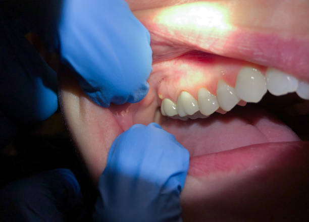 Best Knocked-Out Tooth Emergency  in Elko New Market, MN