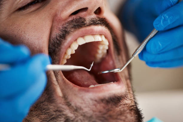 Emergency Gum Pain Relief in MN